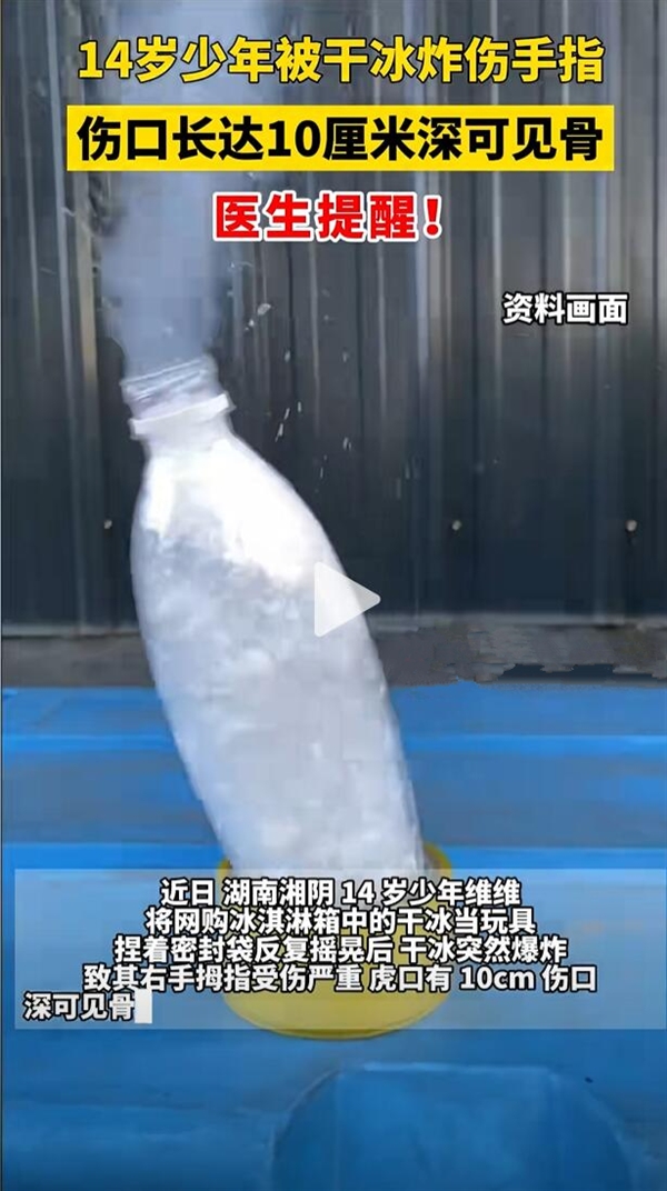 少年被干冰炸伤：手指伤口深可见骨