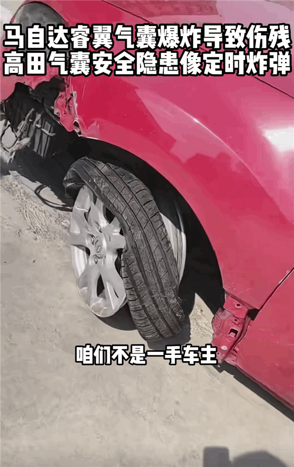 马自达撞车事故 安全气囊底座从手套箱弹出！副驾腿部被炸成粉碎性骨折
