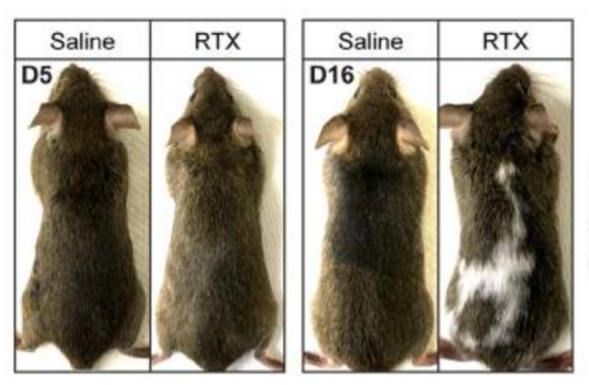 白头发到底能不能拔 真的会越拔越多吗！终于弄清楚了