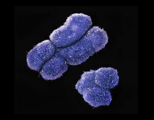 1000多万年后 Y染色体可能要消失 到时男性会怎么样