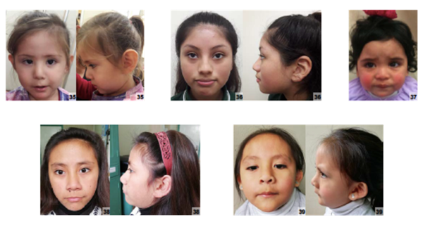 1000多万年后 Y染色体可能要消失 到时男性会怎么样